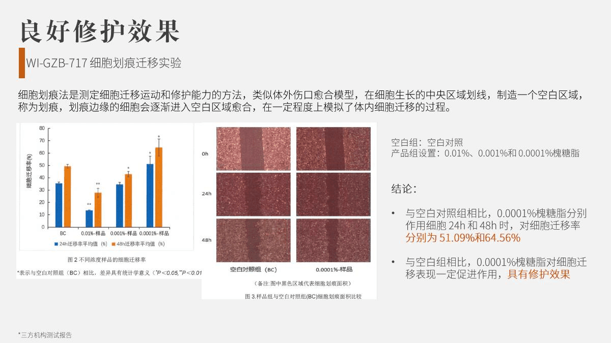 槐糖脂不同浓度细胞划痕迁移模型的24与48小时结果